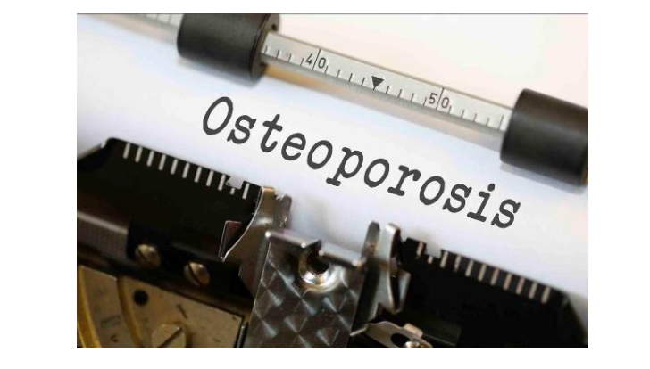 What Every Woman Needs to Know About Osteoporosis